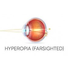 Refractive Error – Far vision -Hyperopia